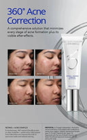 ZO Skin Health Retinol + Blemish Complex – 50ml