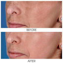 ZO Skin Health Retinol Skin Brightener (1% Retinol) Reisegrösse